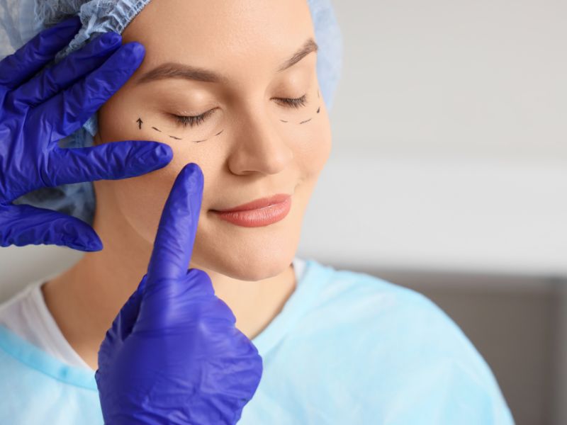 Blepharoplasty