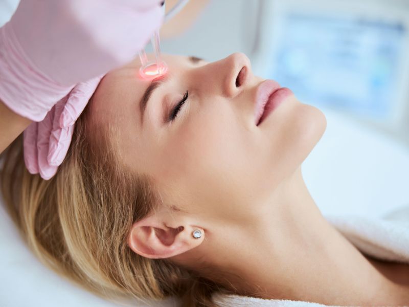 blepharoplasty with co2 laser