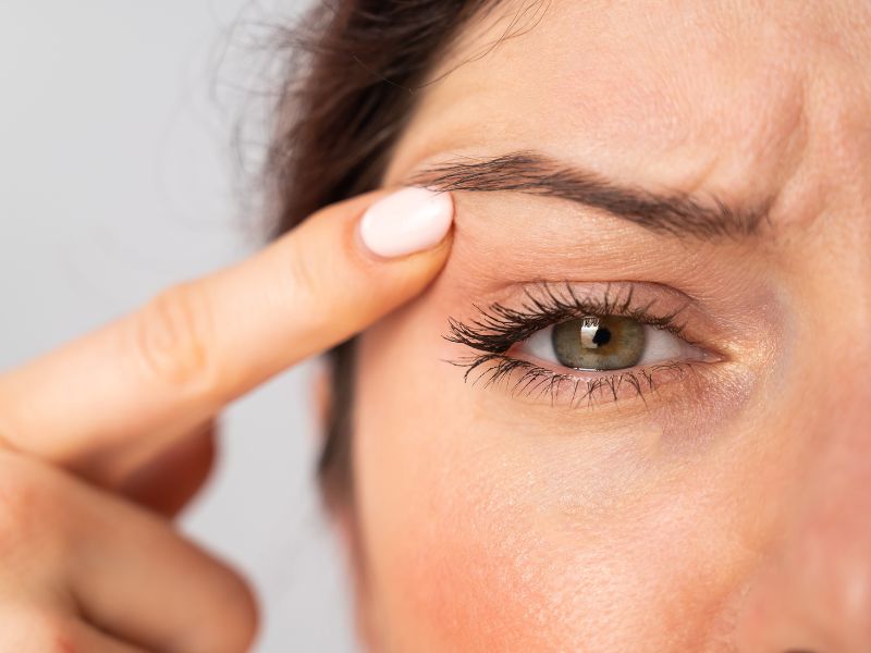 non surgical blepharoplasty with co2 laser