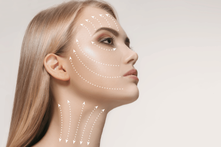 Bioestimulação injectavel