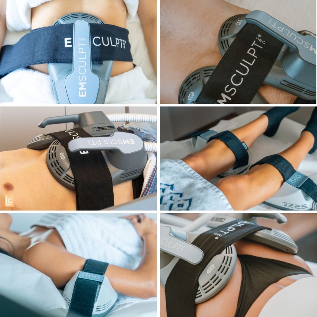 Eletroestimulação Muscular | Como funciona, preço, antes e depois
