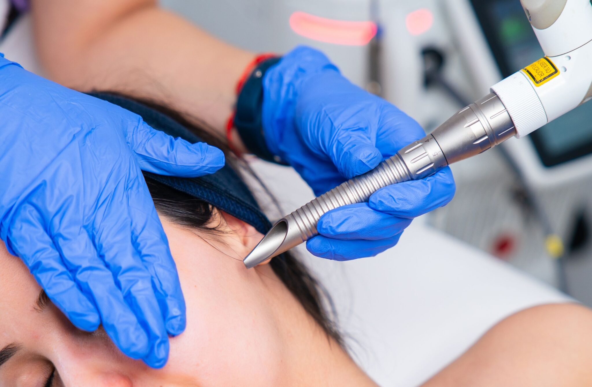 Laser Fotona: para que serve, número de sessões e preço